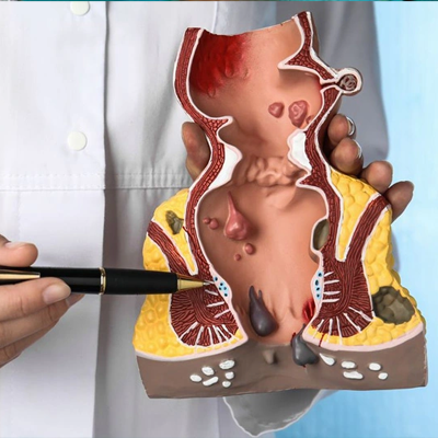 Laser & Perianal Surgery