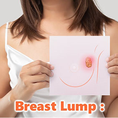 Breast Lump Surgery