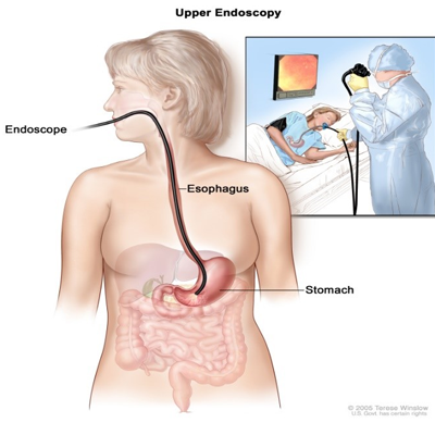 Endoscopy & Colonoscopy