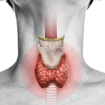 Thyroid Surgery